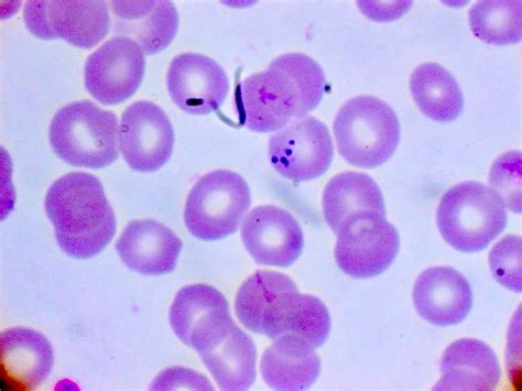  Babesia! A Tiny Parasite Capable of Transforming Blood Cells into its Own Personal Factories