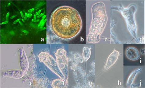  Opercularia! A Tiny Amoeba That Wears Its Home Like a Cap